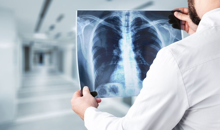 X-RAY'S